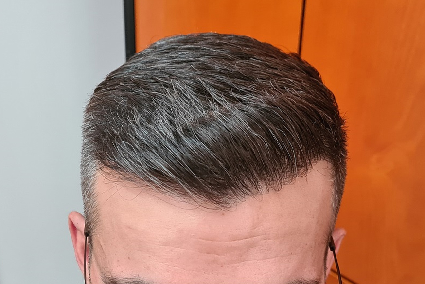 after front