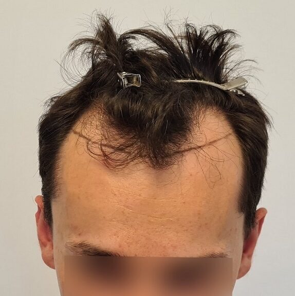 Before