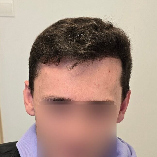 After 12 months