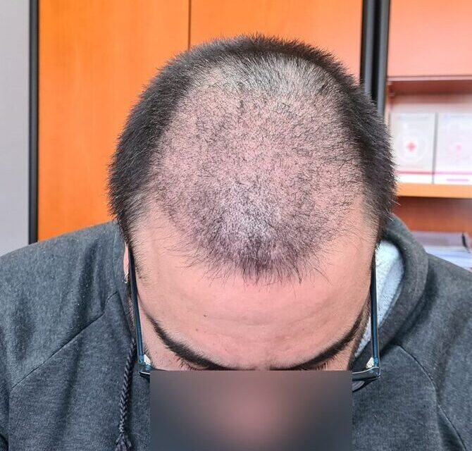 6. one month after