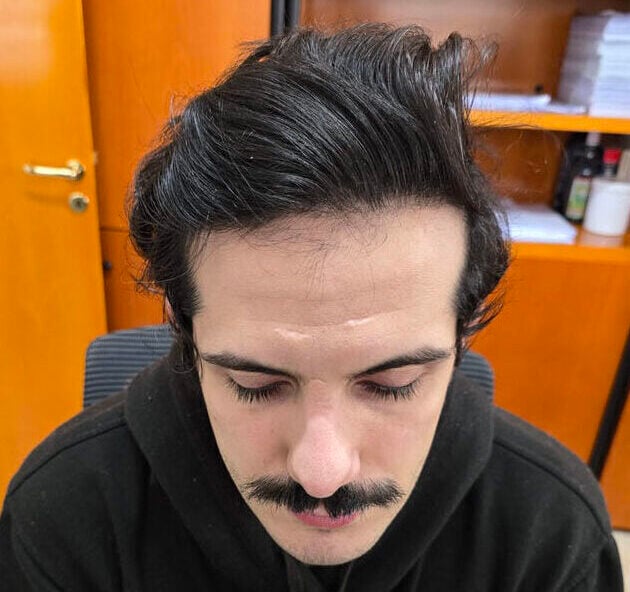 After