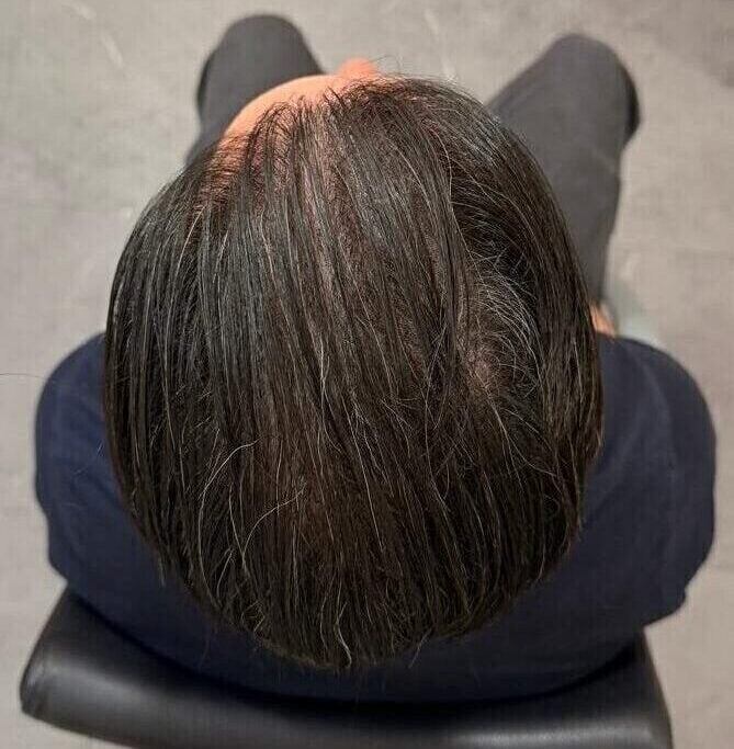 Crown After