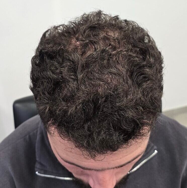 After